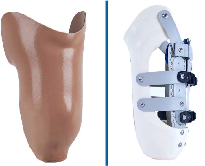 CONVENTIONAL BELOW-KNEE PROSTHESIS MADE OF PLASTIC MATERIAL